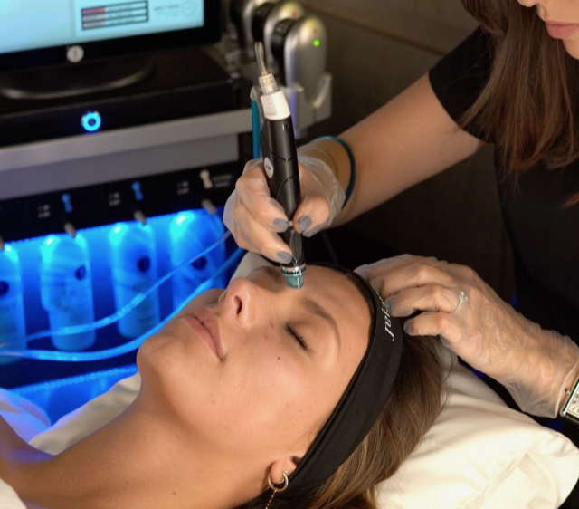 Hydrafacial à Montpelier Dermastories